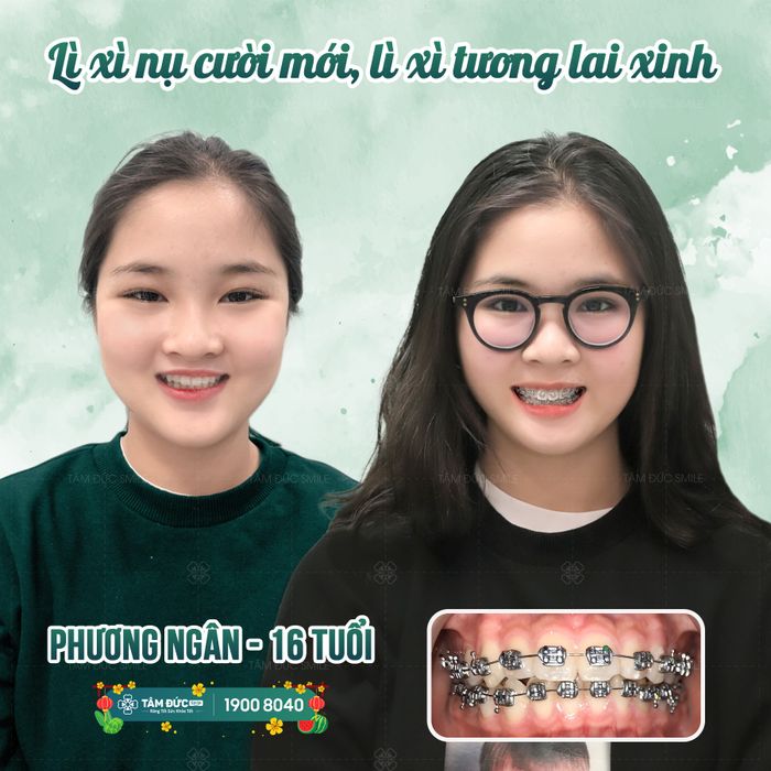 Hình ảnh Nha Khoa Tâm Đức Smile - Vũng Tàu 2