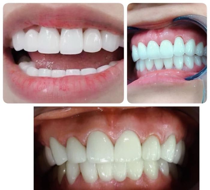 Ảnh Nha Khoa Thẩm Mỹ Đà Nẵng 2