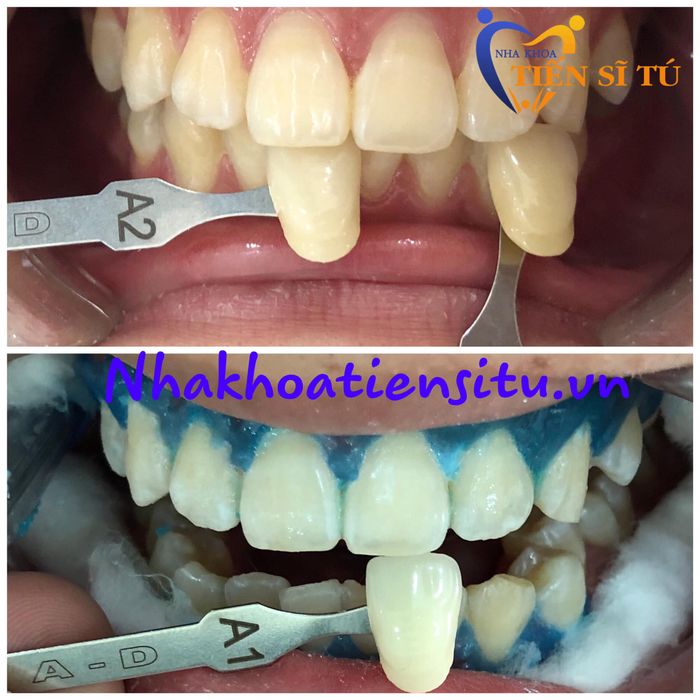 Nha Khoa Tiến Sĩ Tú hình ảnh 2
