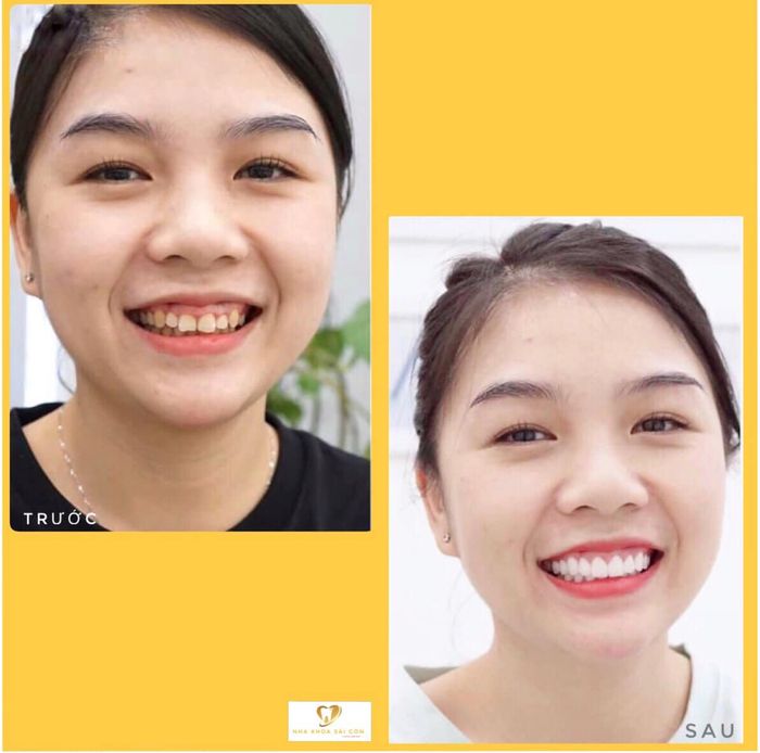 Hình ảnh Nha Khoa Sài Gòn Long Xuyên 1