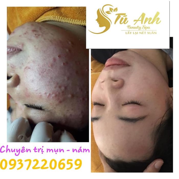 Hình ảnh 1 của Spa Tú Anh