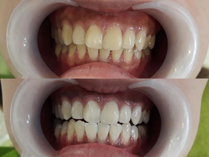 Ảnh Nha Khoa Thăng Long International 2