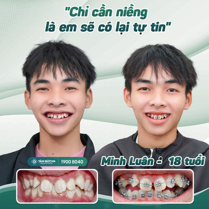 Hình ảnh Nha Khoa Tâm Đức Smile - Vũng Tàu 1
