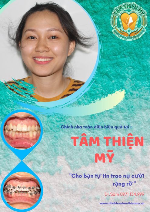 Hình ảnh 1 của Nha khoa Tâm Thiện Mỹ