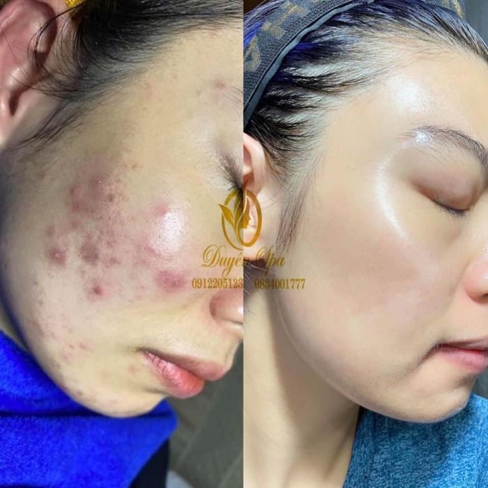 Hình ảnh Duyên Spa 2