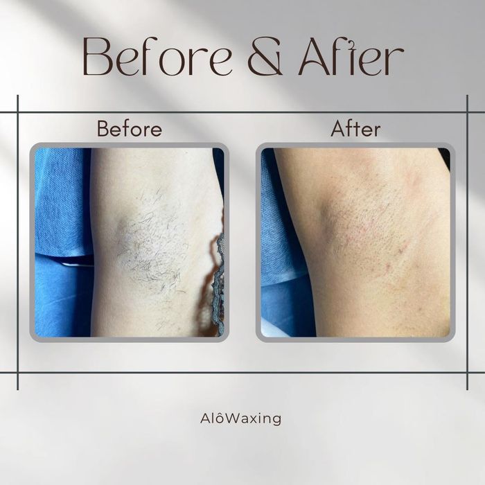 Ảnh 2 của Alô Waxing