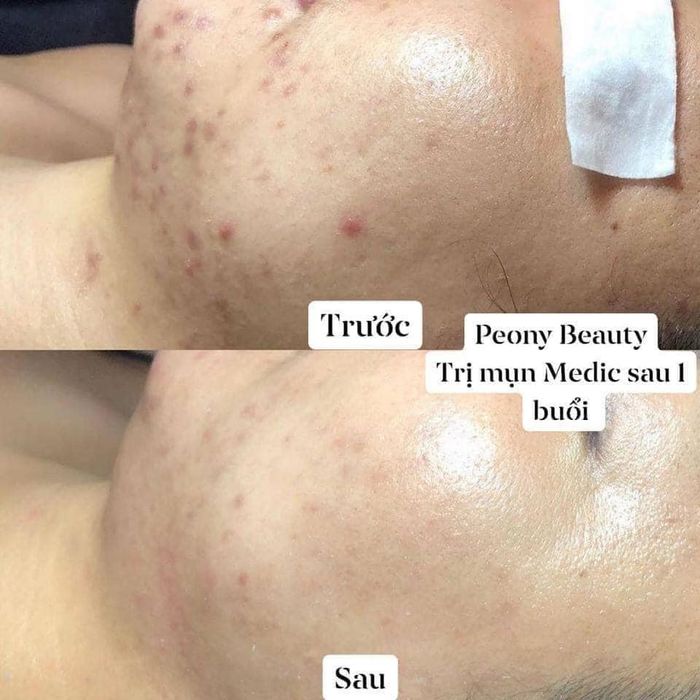 Hình ảnh Duyên Spa 1