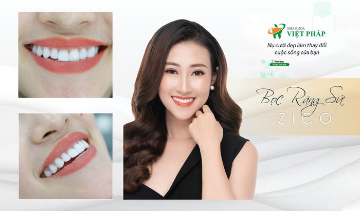Ảnh Nha Khoa Việt Pháp 1