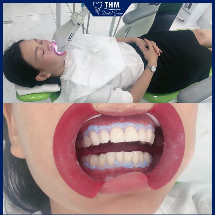 Hình ảnh Nha Khoa Thế Hệ Mới 2