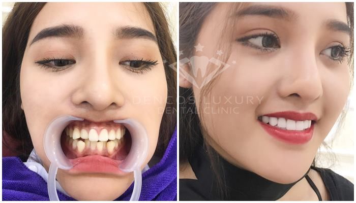 Hình ảnh của Dencos Luxury - Viện nha khoa thẩm mỹ tại Thanh Hóa