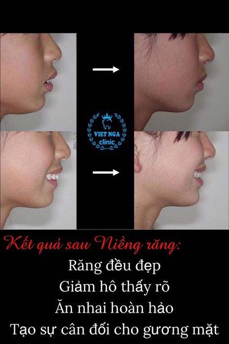 Hình ảnh NHA KHOA VIỆT NGA 1