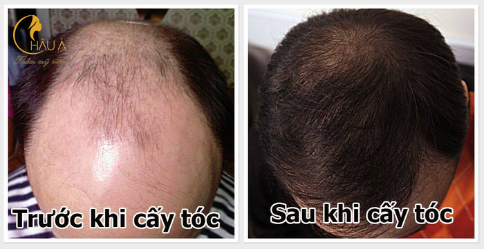 Hình ảnh Thẩm Mỹ Viện Châu Á 2