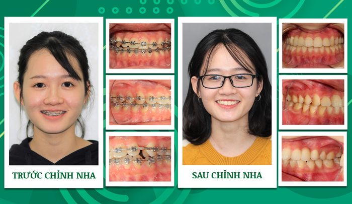 Ảnh 1 của Nha khoa Trẻ