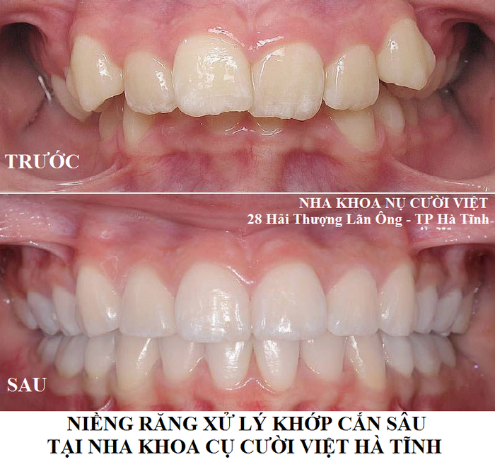 Hình ảnh Nha khoa Nụ Cười Việt - Hà Tĩnh 1
