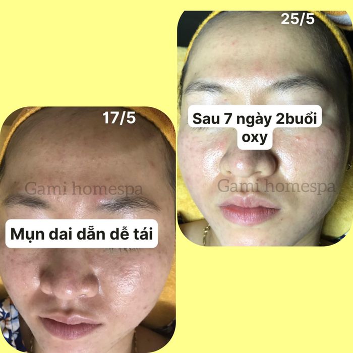 Ảnh minh họa (Nguồn: Gami Homespa) hình 1