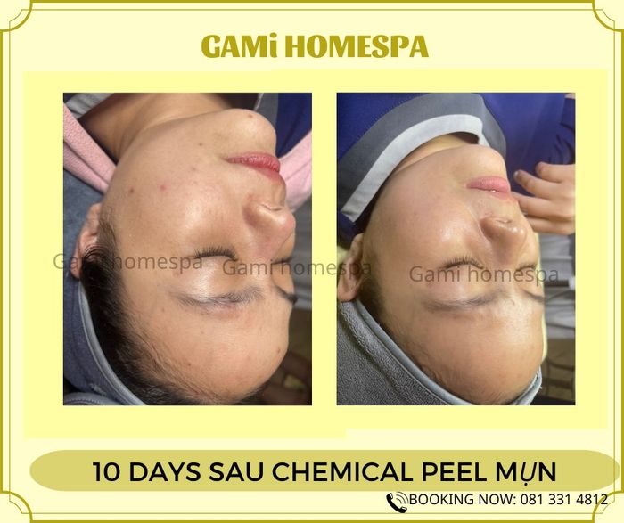 Ảnh minh họa (Nguồn: Gami Homespa) hình 1