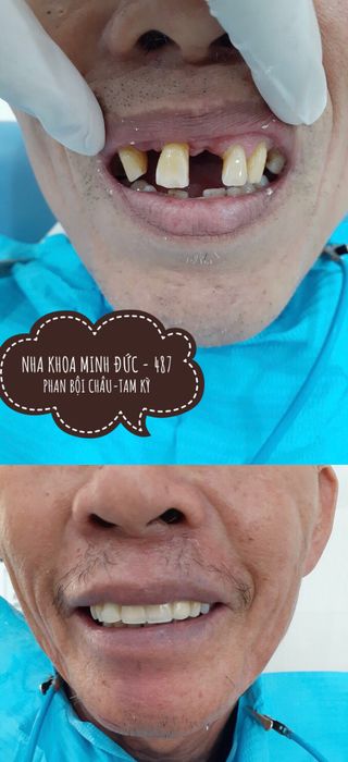 Hình ảnh 2 của Phòng khám Nha khoa Minh Đức tại Tam Kỳ