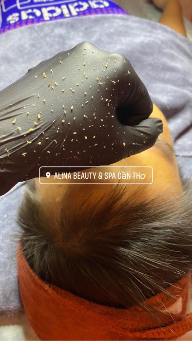 Hình ảnh ALINA Beauty & Spa 2