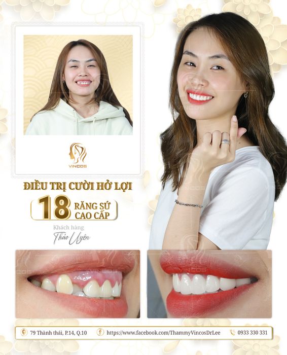 Hình ảnh Thẩm Mỹ VinCos & Dr Lee 2