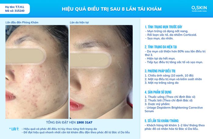 Hình ảnh minh hoạ (Nguồn: Phòng Khám Da Liễu O2 SKIN) - hình 1