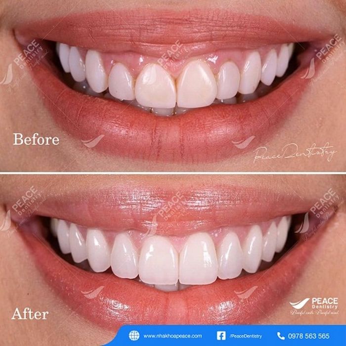 Hình ảnh Peace Dentistry 2