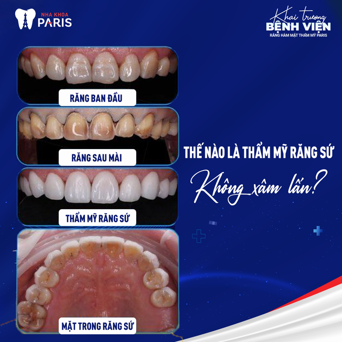 Nha Khoa Paris - Hình ảnh 2