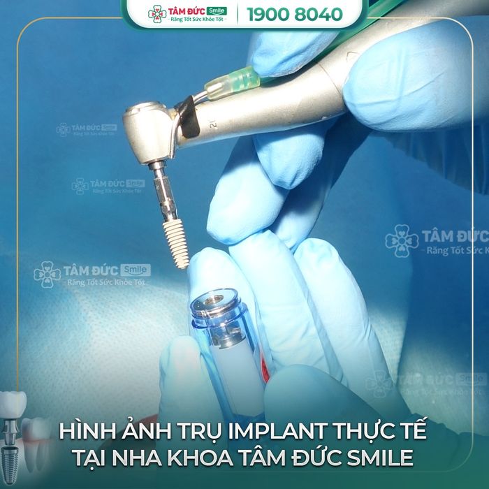 Ảnh Nha Khoa Tâm Đức Smile 2