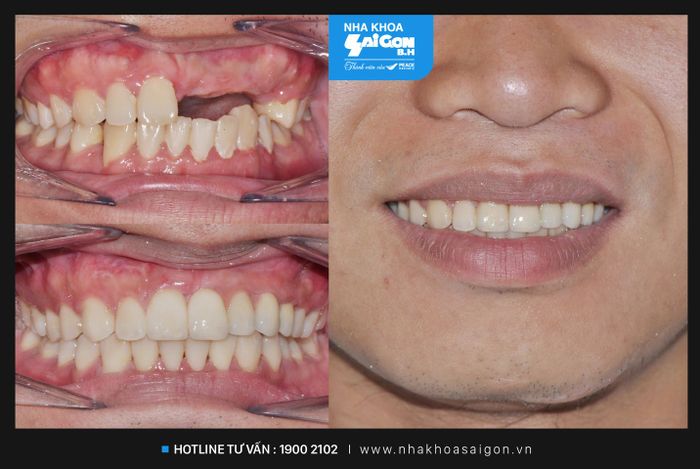 Hình ảnh 2 của Nha Khoa Sài Gòn B.H
