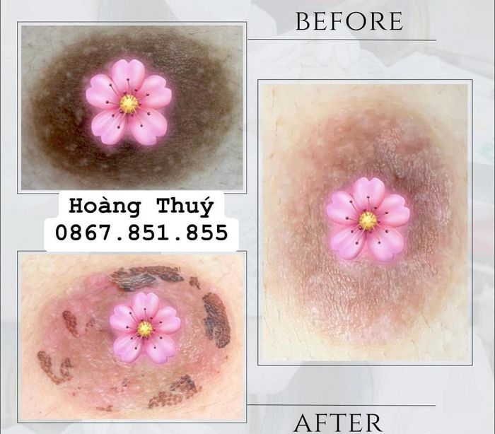 Hình ảnh Thẩm Mỹ Viện Hoàng Thúy 2