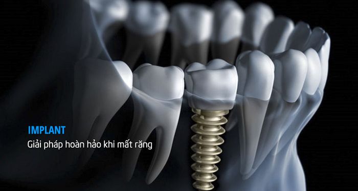 Hình ảnh Nha Khoa Linh Thiện 2