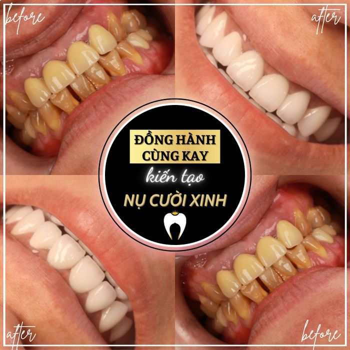 Nha Khoa Quốc Tế Kay - Hình ảnh 1
