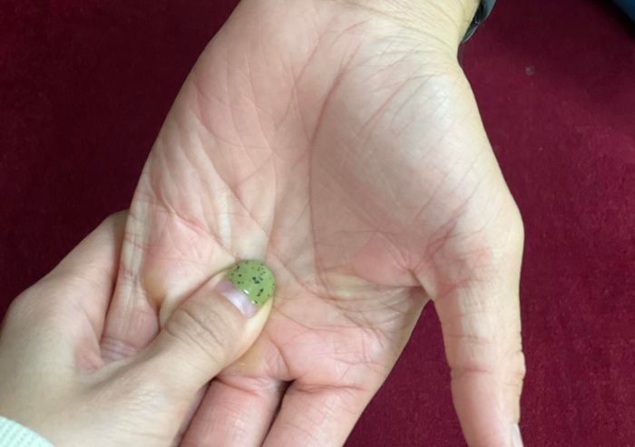 Minh họa (Nguồn internet) ảnh 1