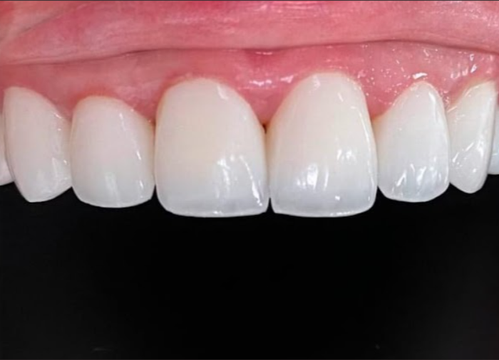 Ảnh 1 của Nha Khoa Bến Thành Sài Gòn