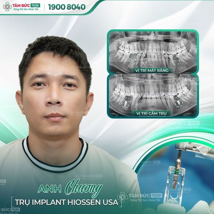 Hình ảnh Nha Khoa Tâm Đức Smile 1