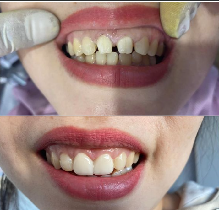 Nha Khoa Minh Anh - Hình 2