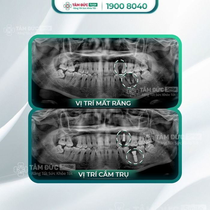 Ảnh Nha Khoa Tâm Đức Smile 1