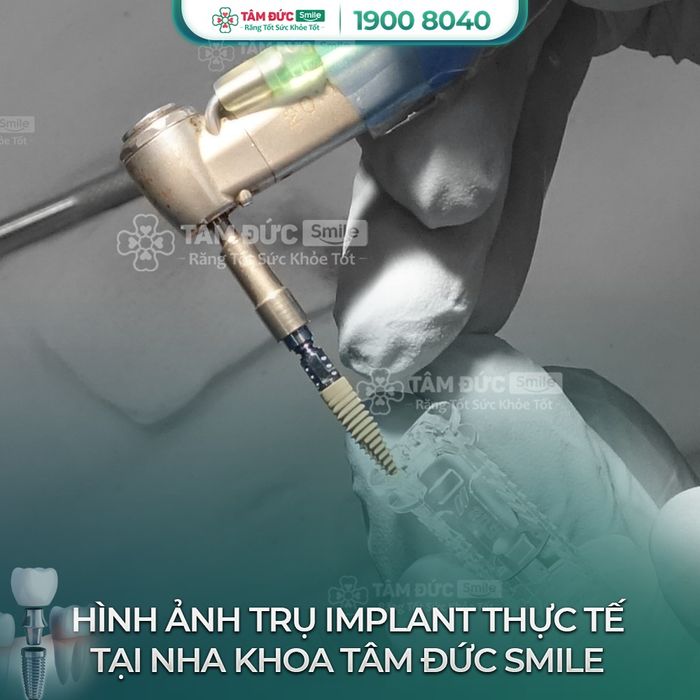 Hình ảnh Nha Khoa Tâm Đức Smile 2