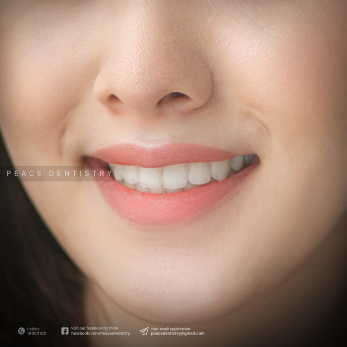 Hình ảnh 1 của Peace Dentistry