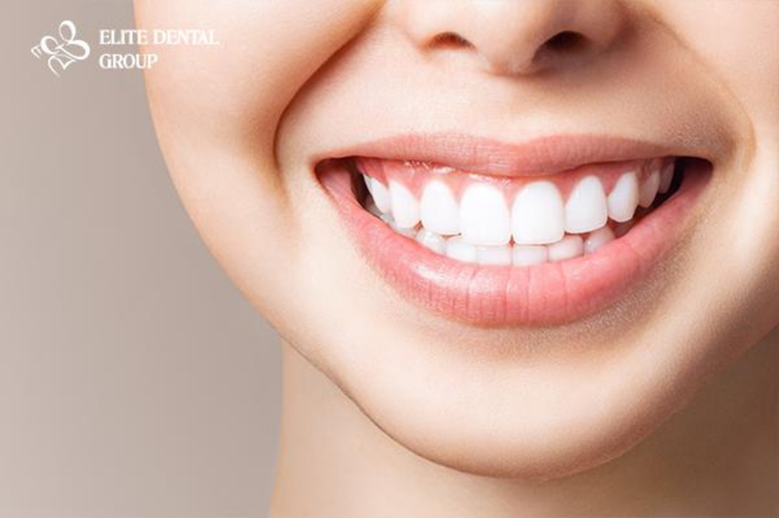 Hình ảnh 1 của Elite Dental
