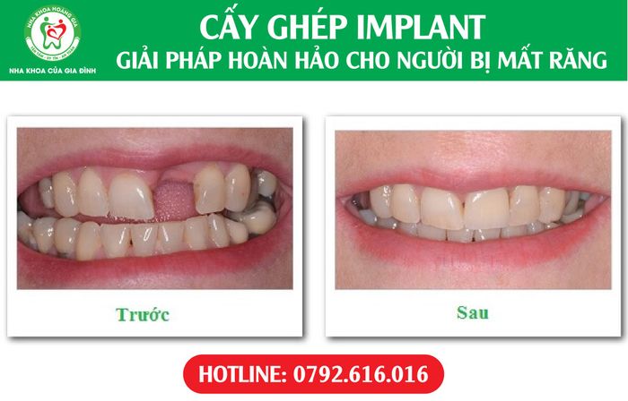 Nha Khoa Hoàng Gia Biên Hòa - Hình 2