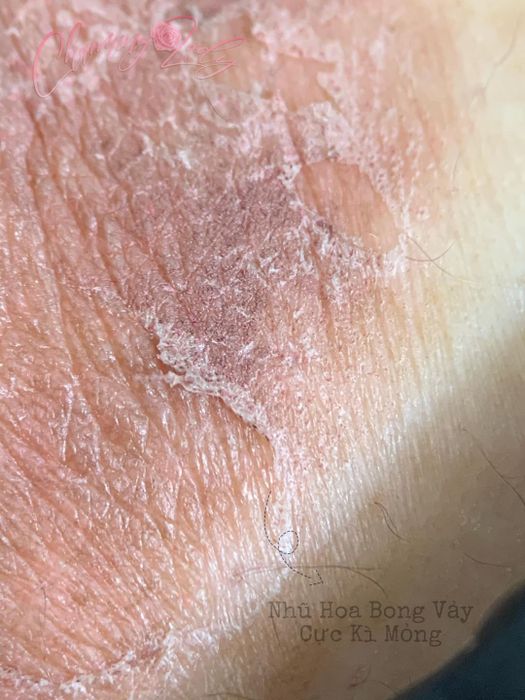 Hình ảnh Thẩm Mỹ Viện Hoàng Thúy 1