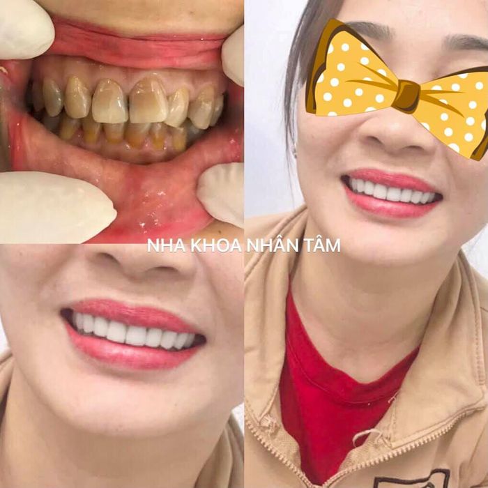 Hình ảnh Nha Khoa Nhân Tâm 2
