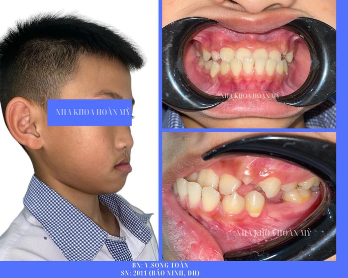 Hình ảnh của Nha khoa Hoàn Mỹ số 2