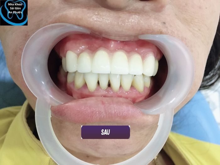 Nha Khoa Sài Gòn An Phước hình 2