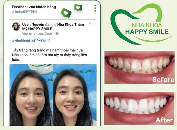Hình ảnh Nha Khoa Happy Smile 2