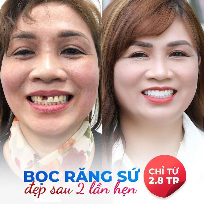 Hình ảnh Nha Khoa Paris Nghệ An 2