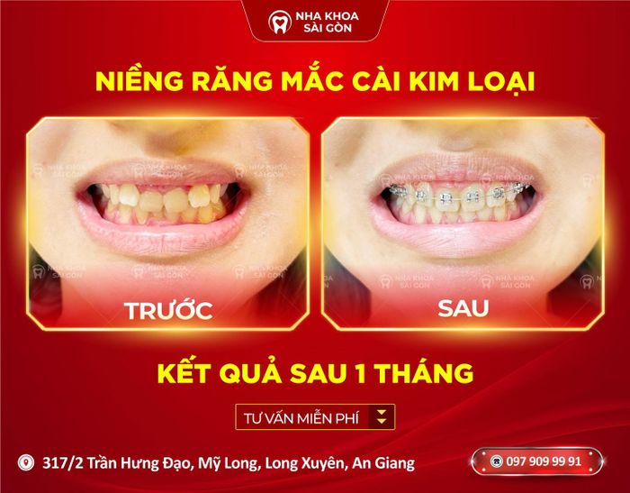 Hình ảnh Nha Khoa Sài Gòn 2