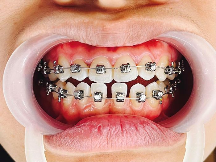 Ảnh của Nha Khoa Minh Đại 2
