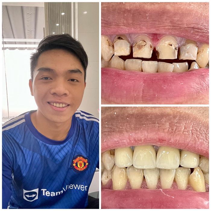 Hình ảnh NHA KHOA NỤ CƯỜI 2