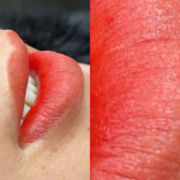 Ảnh Thẩm Mỹ Bảo Hân 1